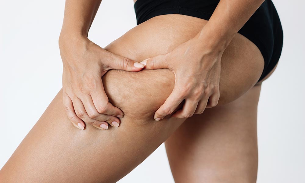 acoustic-wave-cellulite