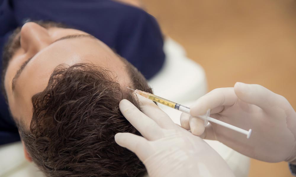 prp-hair-loss