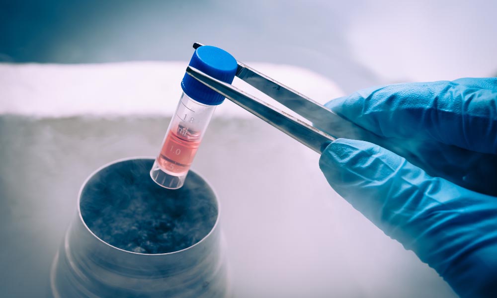 stem-cell-joint-pain