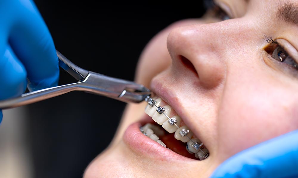 orthodontics Services